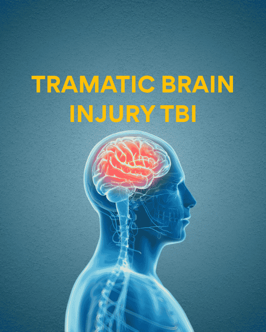 Brain Injury
