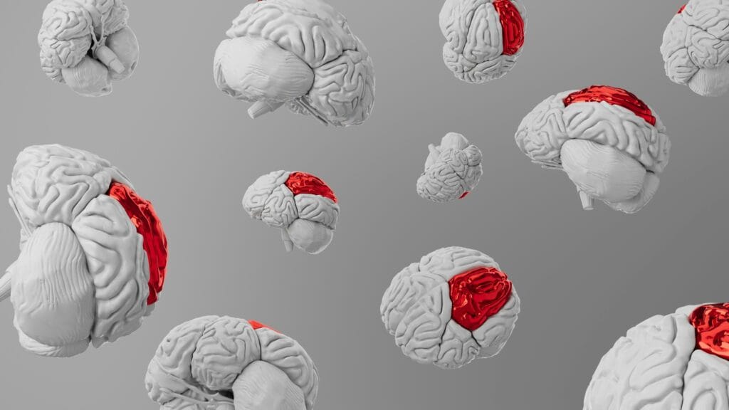 Traumatic brain injury lawyer in Burbank, California consulting with medical experts to calculate lifetime care and recovery damages for a TBI victim.